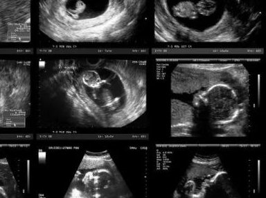 试管移植后别用冷水洗衣服，小心感冒和腹泻找上门！