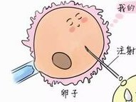 试管婴儿问题多？试管婴儿问题渐显？