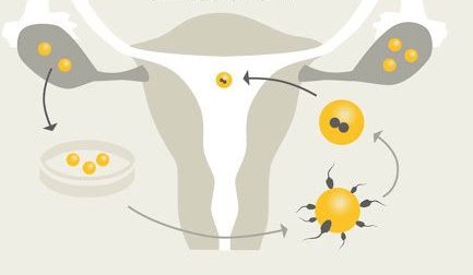 都说一代试管婴儿多，那试管做一对要多少费用？